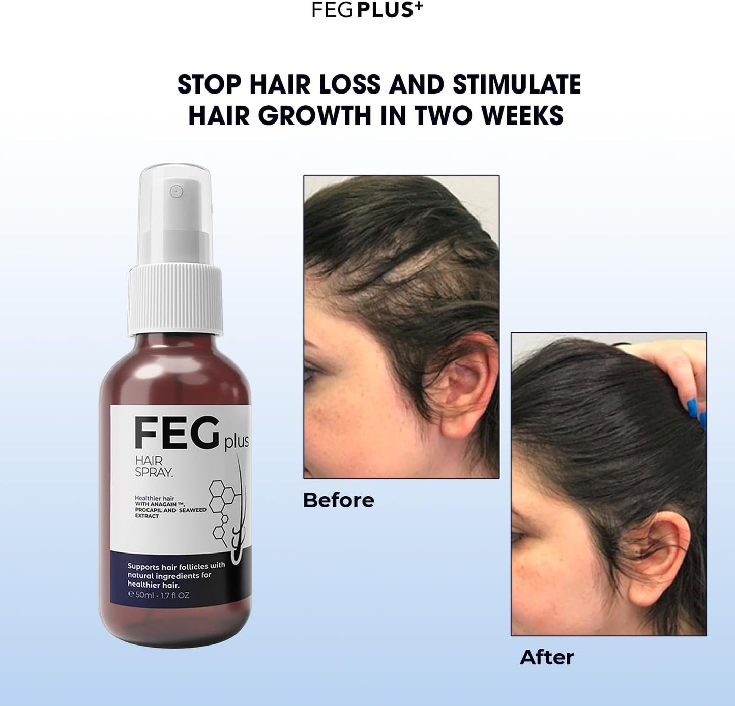FEG Plus Hair Growth Spray (100%Original) Mega Souq